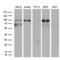 ERCC Excision Repair 3, TFIIH Core Complex Helicase Subunit antibody, LS-C792039, Lifespan Biosciences, Western Blot image 