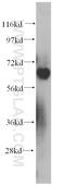 Protein Inhibitor Of Activated STAT 4 antibody, 14242-1-AP, Proteintech Group, Western Blot image 