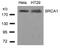 BRCA1 DNA Repair Associated antibody, 79-376, ProSci, Western Blot image 