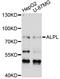 Alkaline Phosphatase, Biomineralization Associated antibody, LS-C747502, Lifespan Biosciences, Western Blot image 