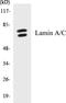 Lamin A/C antibody, EKC1336, Boster Biological Technology, Western Blot image 