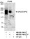 DNA repair protein complementing XP-G cells antibody, NB100-74612, Novus Biologicals, Western Blot image 