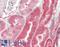 Von Hippel-Lindau disease tumor suppressor antibody, LS-B10235, Lifespan Biosciences, Immunohistochemistry paraffin image 