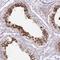 Putative uncharacterized protein CXorf30 antibody, HPA054859, Atlas Antibodies, Immunohistochemistry paraffin image 