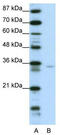 Zinc Finger Protein 177 antibody, TA343403, Origene, Western Blot image 