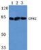Carboxypeptidase N subunit 2 antibody, PA5-75497, Invitrogen Antibodies, Western Blot image 