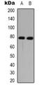 Dynein Axonemal Intermediate Chain 1 antibody, orb339036, Biorbyt, Western Blot image 