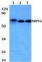 NBPF Member 6 antibody, A18480, Boster Biological Technology, Western Blot image 