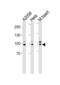 Enhancer Of Polycomb Homolog 1 antibody, abx034869, Abbexa, Western Blot image 