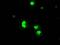 Serine/threonine-protein kinase PRKY antibody, MA5-24954, Invitrogen Antibodies, Immunocytochemistry image 