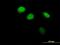Zinc Finger And BTB Domain Containing 12 antibody, H00221527-B01P, Novus Biologicals, Immunocytochemistry image 