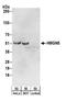 High mobility group nucleosome-binding domain-containing protein 5 antibody, A304-206A, Bethyl Labs, Western Blot image 