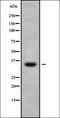 Complement C3a Receptor 1 antibody, orb336383, Biorbyt, Western Blot image 