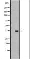 Integrin Subunit Alpha D antibody, orb337791, Biorbyt, Western Blot image 