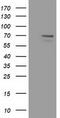 MAGUK p55 subfamily member 3 antibody, M11924, Boster Biological Technology, Western Blot image 