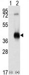 Calcium/Calmodulin Dependent Protein Kinase I antibody, AP13883PU-N, Origene, Western Blot image 