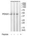 Pyruvate Dehydrogenase E1 Alpha 1 Subunit antibody, TA311767, Origene, Western Blot image 