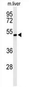 Zinc Finger DHHC-Type Containing 9 antibody, AP54641PU-N, Origene, Western Blot image 