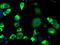 Lysyl Oxidase antibody, M00575-2, Boster Biological Technology, Immunofluorescence image 
