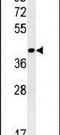 Ring Finger Protein 208 antibody, PA5-25646, Invitrogen Antibodies, Western Blot image 