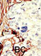 Serine/threonine-protein kinase 11 antibody, abx033257, Abbexa, Immunohistochemistry paraffin image 