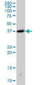 SH3 Domain Containing GRB2 Like 2, Endophilin A1 antibody, LS-C133436, Lifespan Biosciences, Western Blot image 