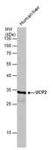 Uncoupling Protein 2 antibody, PA5-78214, Invitrogen Antibodies, Western Blot image 