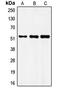 Fibroblast Growth Factor Receptor Substrate 3 antibody, GTX55928, GeneTex, Western Blot image 