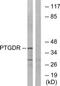 Prostaglandin D2 receptor antibody, TA314400, Origene, Western Blot image 