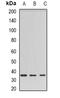 Barttin antibody, orb341343, Biorbyt, Western Blot image 