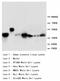 Mitogen-activated protein kinase 3 antibody, LS-C172183, Lifespan Biosciences, Western Blot image 
