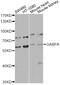 GA-binding protein alpha chain antibody, STJ110717, St John