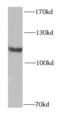 2-oxoglutarate dehydrogenase, mitochondrial antibody, FNab05976, FineTest, Western Blot image 