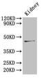 Renin-2 antibody, LS-C285768, Lifespan Biosciences, Western Blot image 