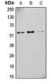Cytochrome P450 Family 2 Subfamily D Member 6 antibody, orb213825, Biorbyt, Western Blot image 
