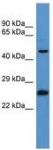 RAB8B, Member RAS Oncogene Family antibody, TA342690, Origene, Western Blot image 