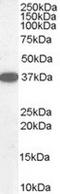 Dimethylarginine Dimethylaminohydrolase 1 antibody, TA302754, Origene, Western Blot image 
