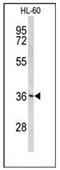 Peroxisomal Biogenesis Factor 14 antibody, AP53261PU-N, Origene, Western Blot image 