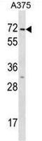 Keratin 75 antibody, AP52422PU-N, Origene, Western Blot image 