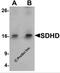 Succinate dehydrogenase [ubiquinone] cytochrome b small subunit, mitochondrial antibody, 6847, ProSci, Western Blot image 
