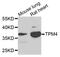 Tropomyosin 4 antibody, abx135735, Abbexa, Western Blot image 