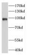 DEAD-Box Helicase 23 antibody, FNab02300, FineTest, Western Blot image 