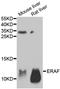 Alpha Hemoglobin Stabilizing Protein antibody, A05948-1, Boster Biological Technology, Western Blot image 