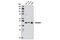 Histone-lysine N-methyltransferase SUV39H1 antibody, 8729T, Cell Signaling Technology, Western Blot image 