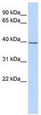 SET Domain Containing 3, Actin Histidine Methyltransferase antibody, TA339158, Origene, Western Blot image 