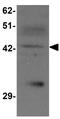 Solute Carrier Family 39 Member 13 antibody, GTX31995, GeneTex, Western Blot image 