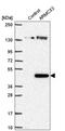 Armadillo Repeat Containing X-Linked 3 antibody, HPA001530, Atlas Antibodies, Western Blot image 