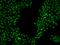 U2 SnRNP Associated SURP Domain Containing antibody, 205852-T02, Sino Biological, Immunohistochemistry paraffin image 