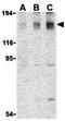 Mitogen-Activated Protein Kinase Kinase Kinase 5 antibody, GTX31728, GeneTex, Western Blot image 