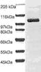 Disintegrin and metalloproteinase domain-containing protein 8 antibody, TA354546, Origene, Western Blot image 